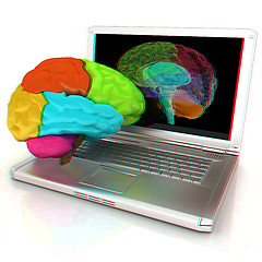 Image showing creative three-dimensional model of real human brain and scan on