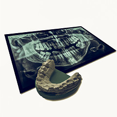 Image showing Vintage looking Xray of teeth with positive teeth cast