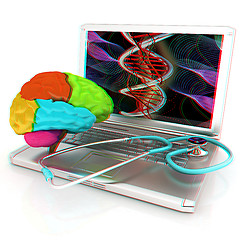 Image showing Laptop, brain and Stethoscope. 3d illustration. Anaglyph. View w