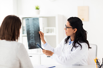 Image showing doctor and patient with spine x-ray at hospital