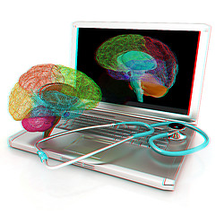 Image showing Laptop, brain and Stethoscope. 3d illustration. Anaglyph. View w