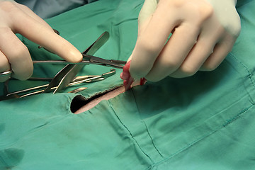 Image showing Surgical procedure