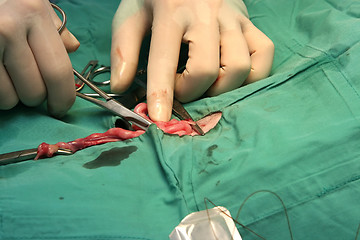 Image showing Surgical procedure