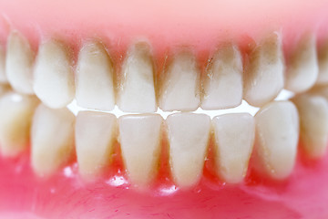 Image showing dirty dental plate