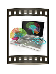 Image showing Laptop, brain and Stethoscope. 3d illustration. The film strip
