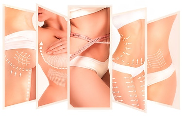 Image showing The cellulite removal plan. White markings on young woman body