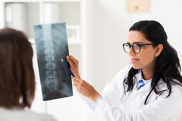 Image showing doctor and patient with spine x-ray at hospital