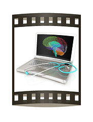 Image showing Laptop, brain and Stethoscope. 3d illustration. The film strip