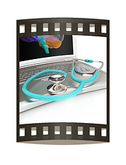 Image showing Laptop, brain and Stethoscope. 3d illustration. The film strip