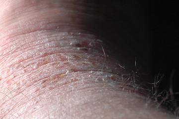 Image showing Skin problem