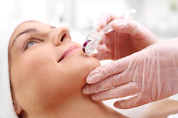 Image showing Mesotherapy microneedle, the woman at the beautician