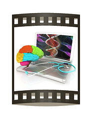 Image showing Laptop, brain and Stethoscope. 3d illustration. The film strip