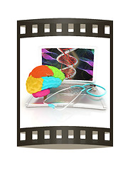 Image showing Laptop, brain and Stethoscope. 3d illustration. The film strip