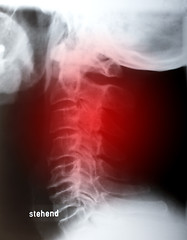 Image showing Human neck sidelong 