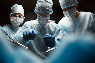 Image showing Photo of surgeons with corncangs