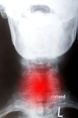 Image showing Human neck in front