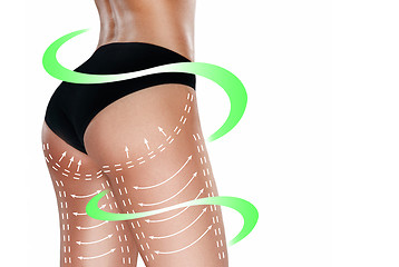 Image showing Marks on the women\'s buttocks, waist and legs before plastic surgery.