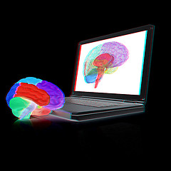 Image showing creative three-dimensional model of real human brain and scan on