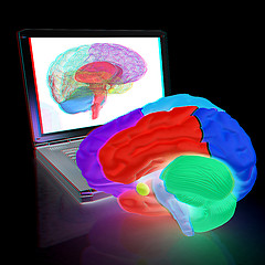 Image showing creative three-dimensional model of real human brain and scan on