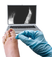 Image showing Foot surgery