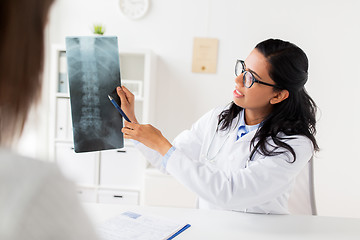 Image showing doctor with x-ray of spine and patient at hospital