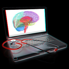 Image showing Laptop, brain and Stethoscope. 3d illustration. Anaglyph. View w