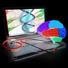 Image showing Laptop, brain and Stethoscope. 3d illustration. Anaglyph. View w