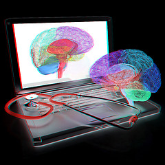 Image showing Laptop, brain and Stethoscope. 3d illustration. Anaglyph. View w