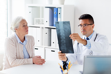 Image showing senior woman and doctor with x-ray at hospital