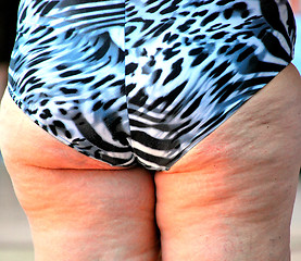 Image showing Female with cellulite.