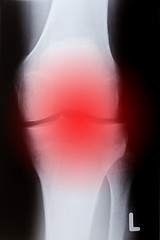 Image showing Human knee in front