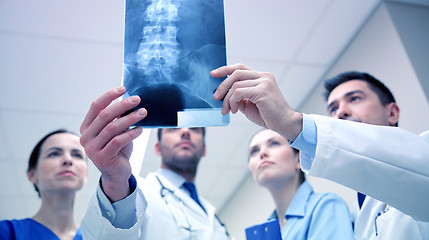 Image showing group of medics with spine x-ray scan at hospital