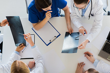 Image showing doctors with spine x-rays and clipboards