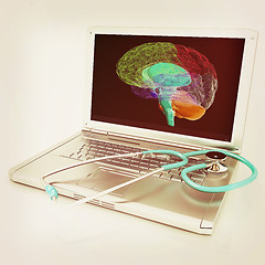 Image showing Laptop, brain and Stethoscope. 3d illustration. Vintage style.