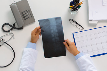 Image showing doctor hands with spine x-ray sitting at table