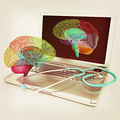 Image showing Laptop, brain and Stethoscope. 3d illustration. Vintage style.