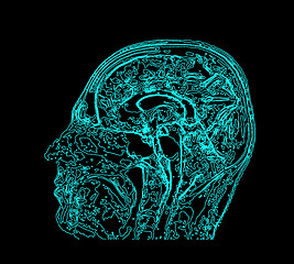 Image showing Topographic map MRI of the human brain.