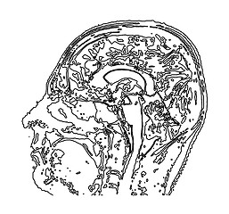 Image showing Topographic map MRI of the human brain.