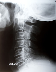 Image showing Human neck sidelong 