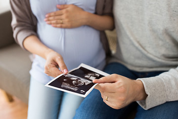 Image showing close up of couple with baby ultrasound images