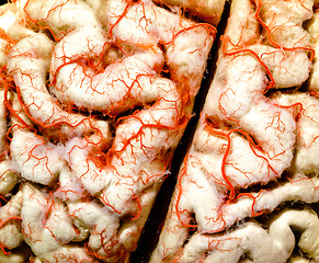 Image showing Human brain closeup
