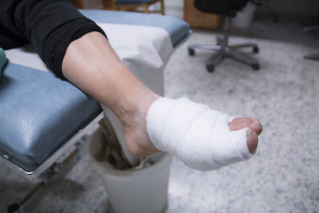 Image showing Broken Leg