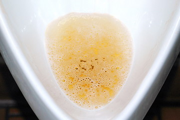 Image showing Urine testing.