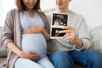 Image showing close up of couple with baby ultrasound images