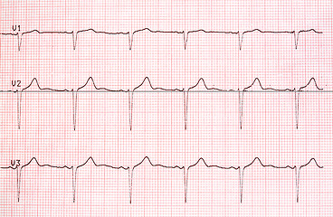 Image showing Electrocardiogram graph on paper