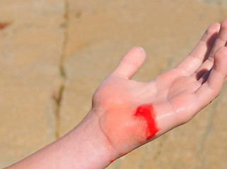 Image showing Wounded hand