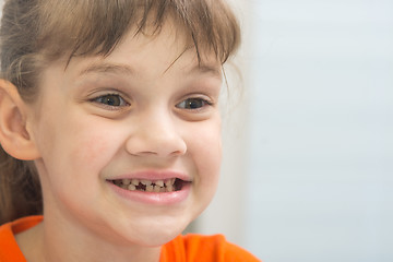 Image showing Seven-year-old girl with a smile looks at her curves baby teeth