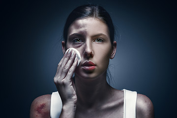 Image showing Close up portrait of a crying woman with bruised skin and black eyes