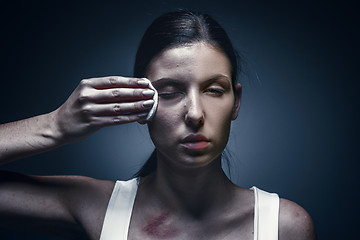 Image showing Close up portrait of a crying woman with bruised skin and black eyes