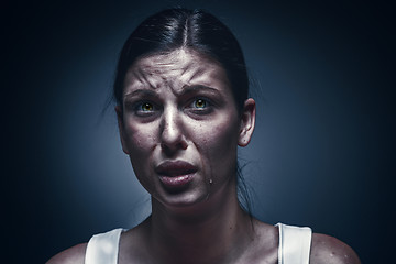 Image showing Close up portrait of a crying woman with bruised skin and black eyes